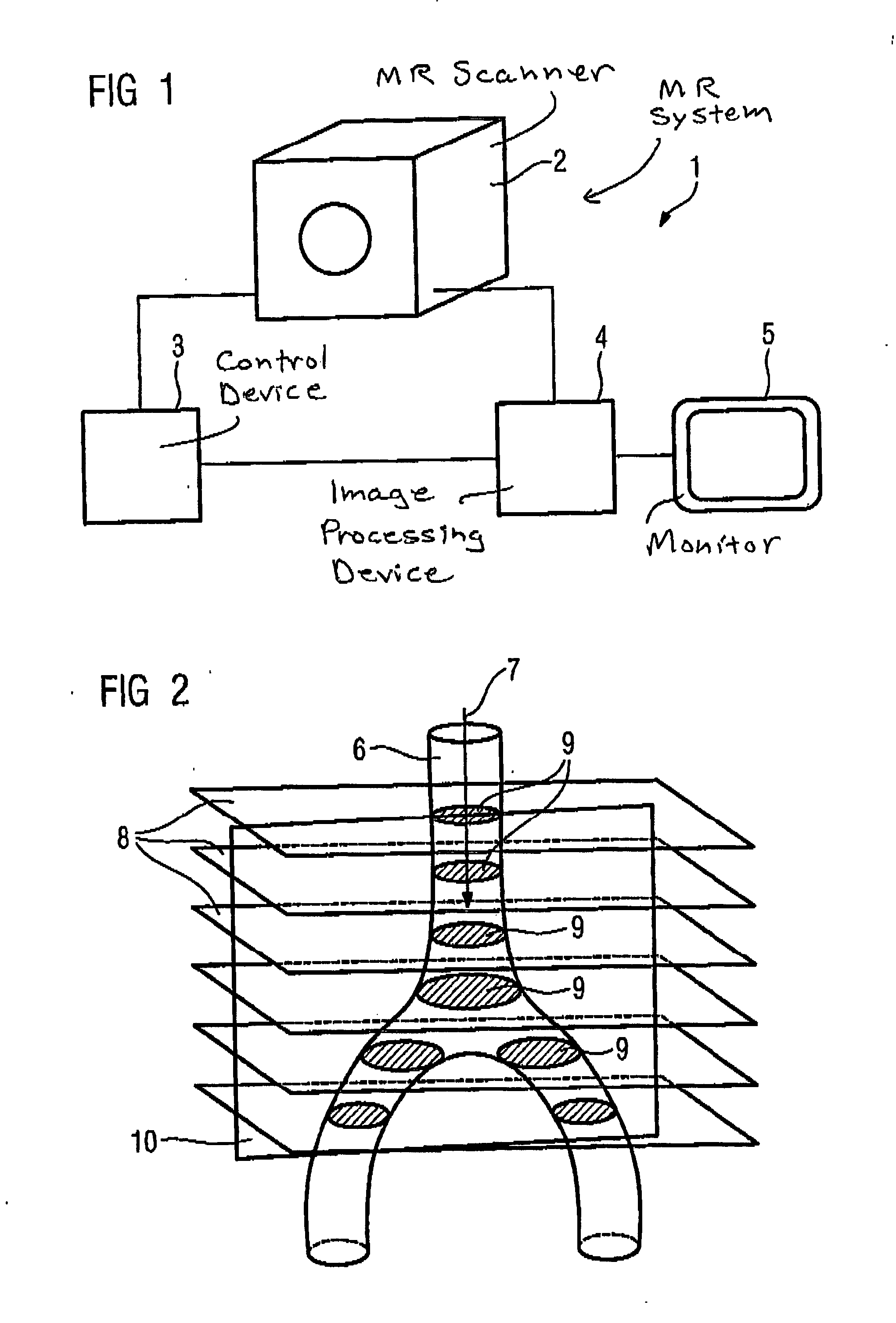 Magnetic resonance method and apparatus for determining the position and/or orientation of the image plane of slice image exposures of a vessel region in a contrast agent bolus examination