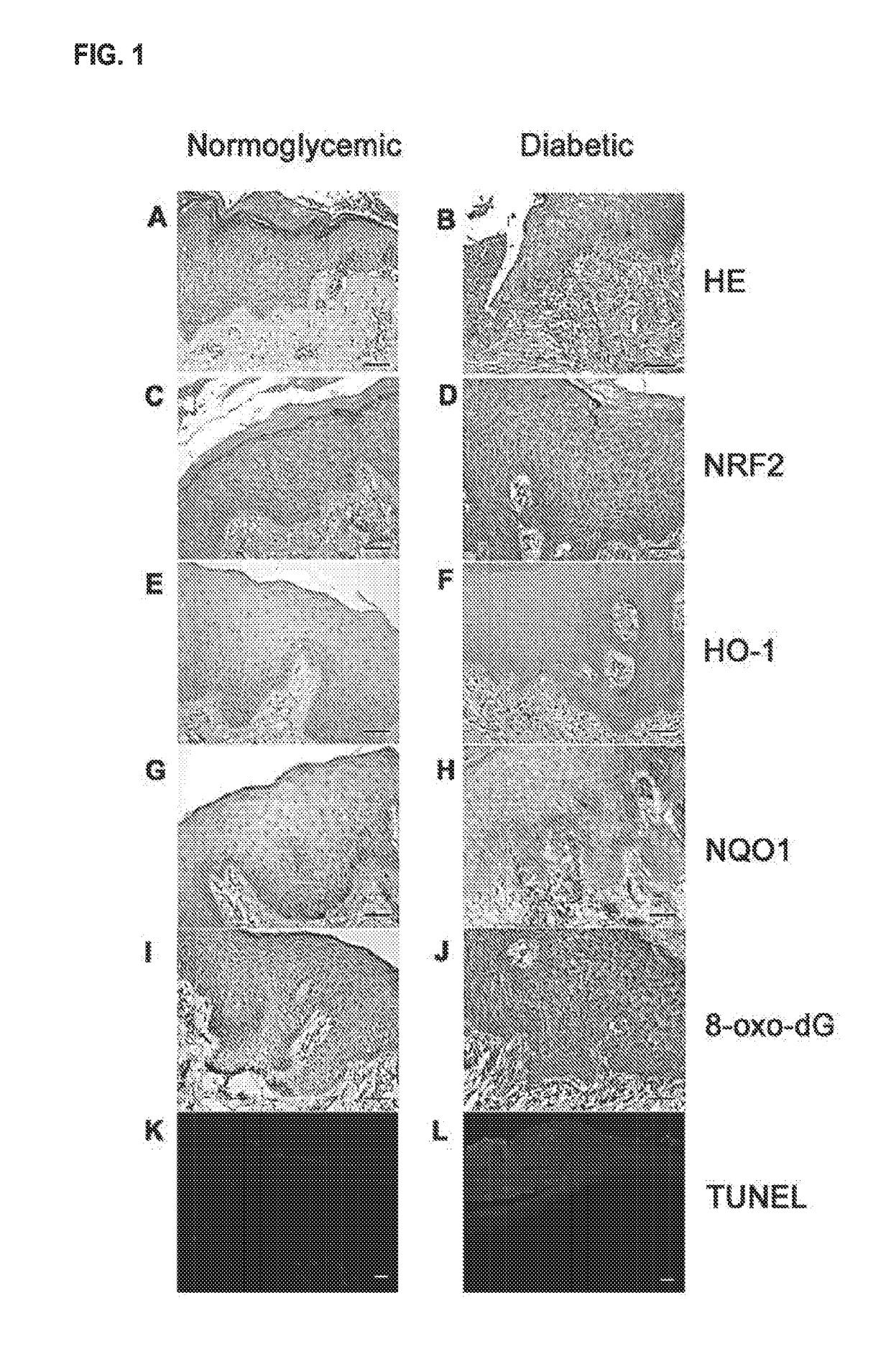 Compositions and methods for treatment, amelioration, and prevention of diabetes-related skin ulcers
