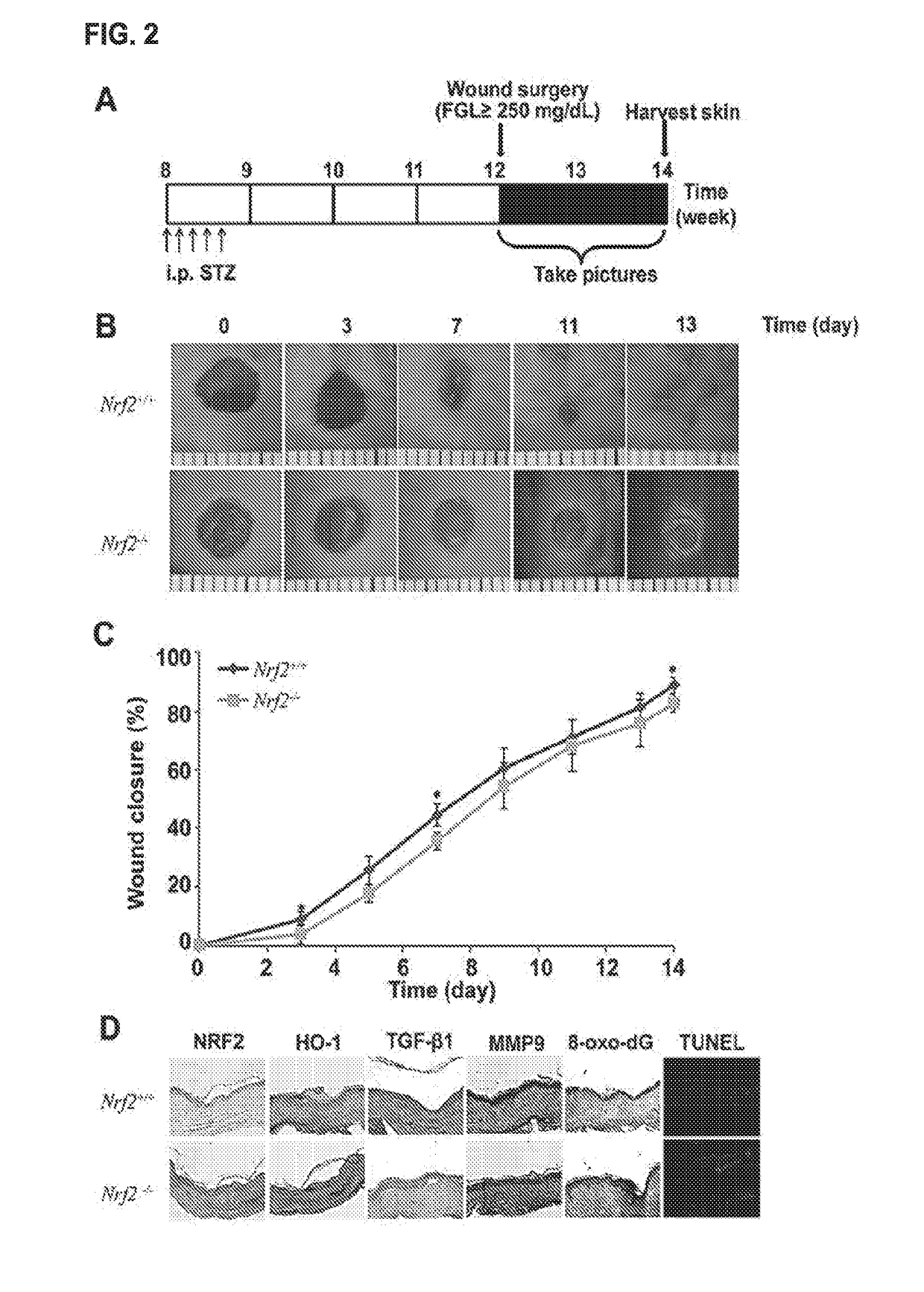 Compositions and methods for treatment, amelioration, and prevention of diabetes-related skin ulcers