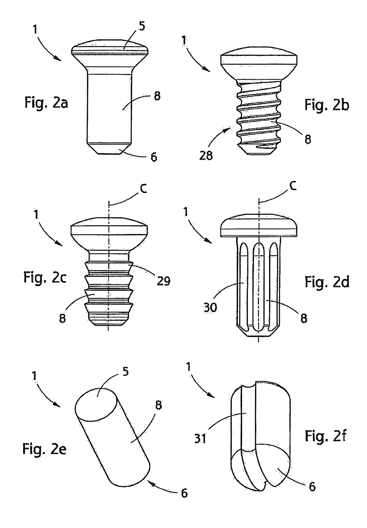 Implant, implantation tool, kit and method