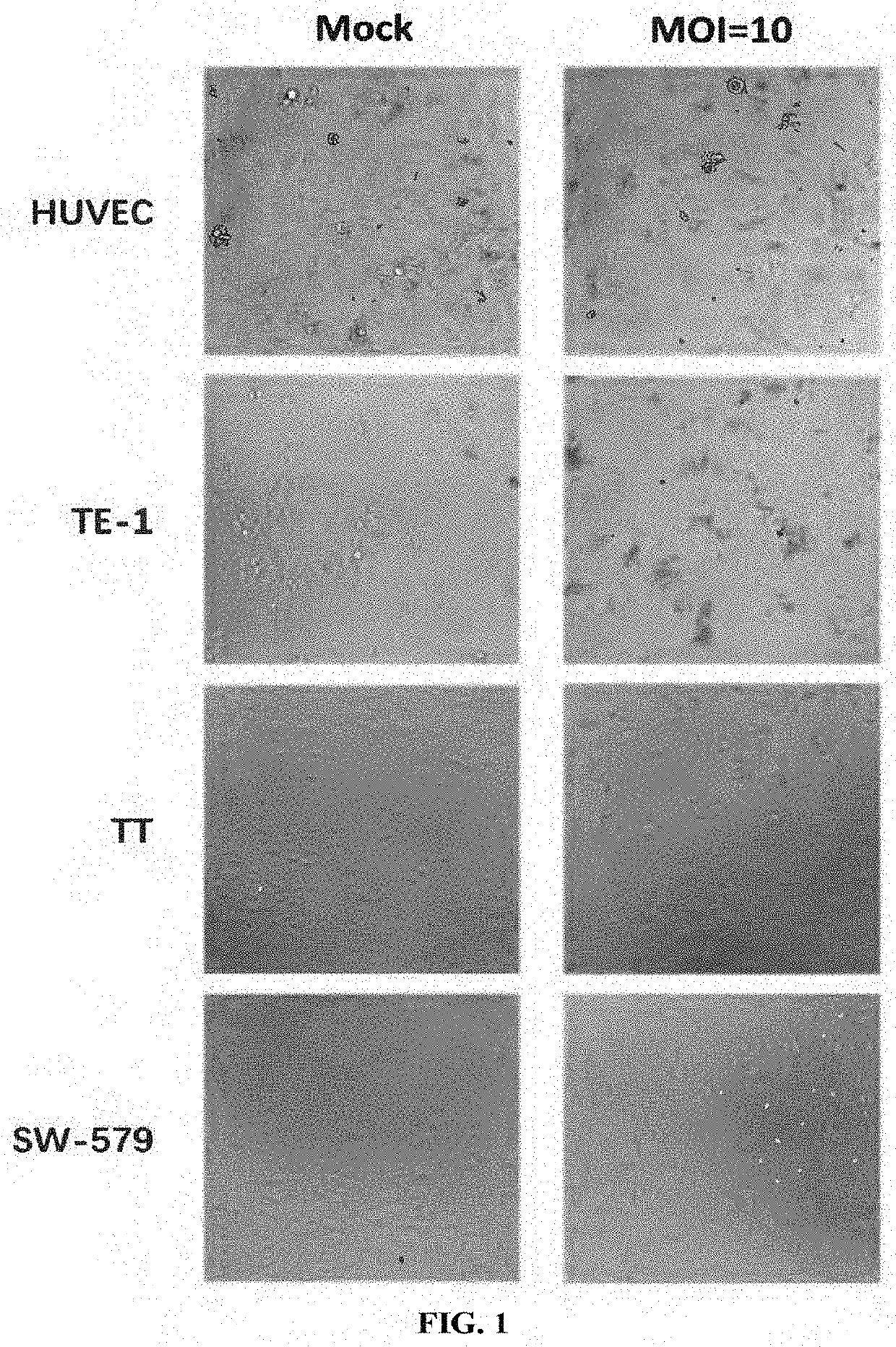 A virus for treatment of tumor