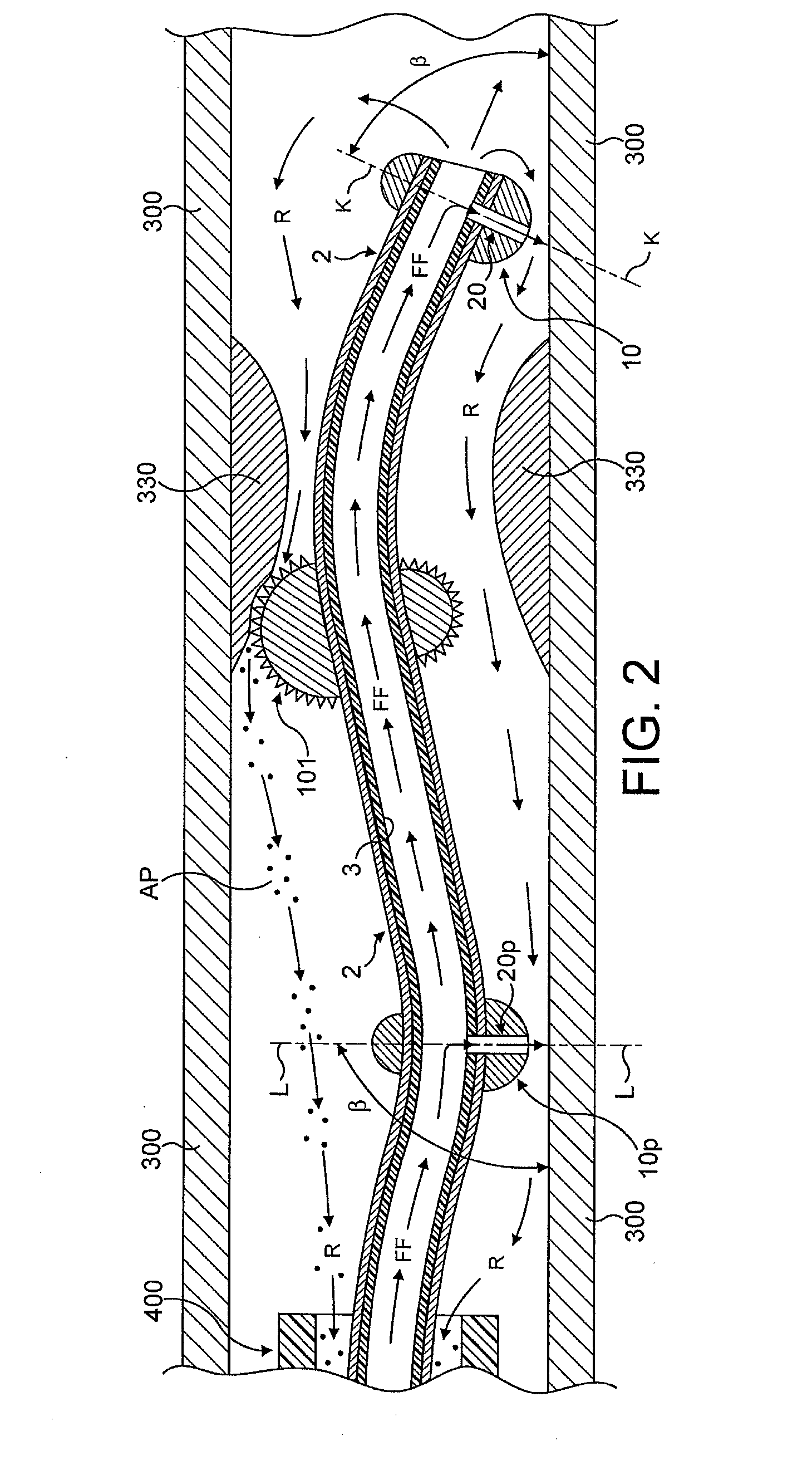 Atherectomy device supported by fluid bearings