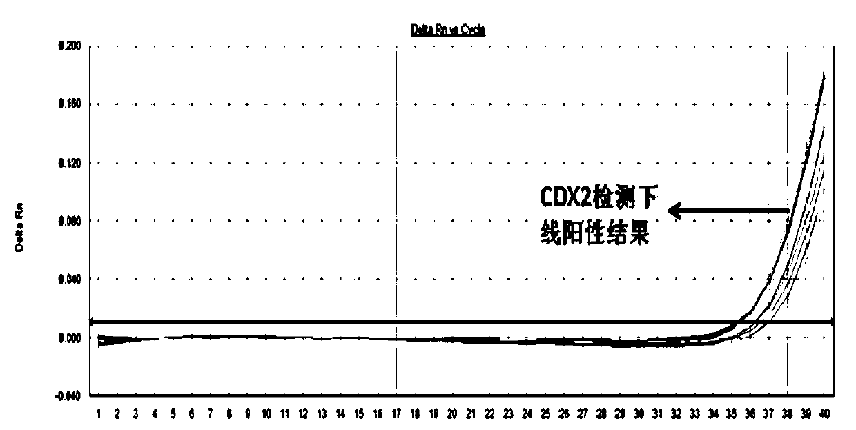 Primers and method for detecting expression level of leukemia cdx2 gene