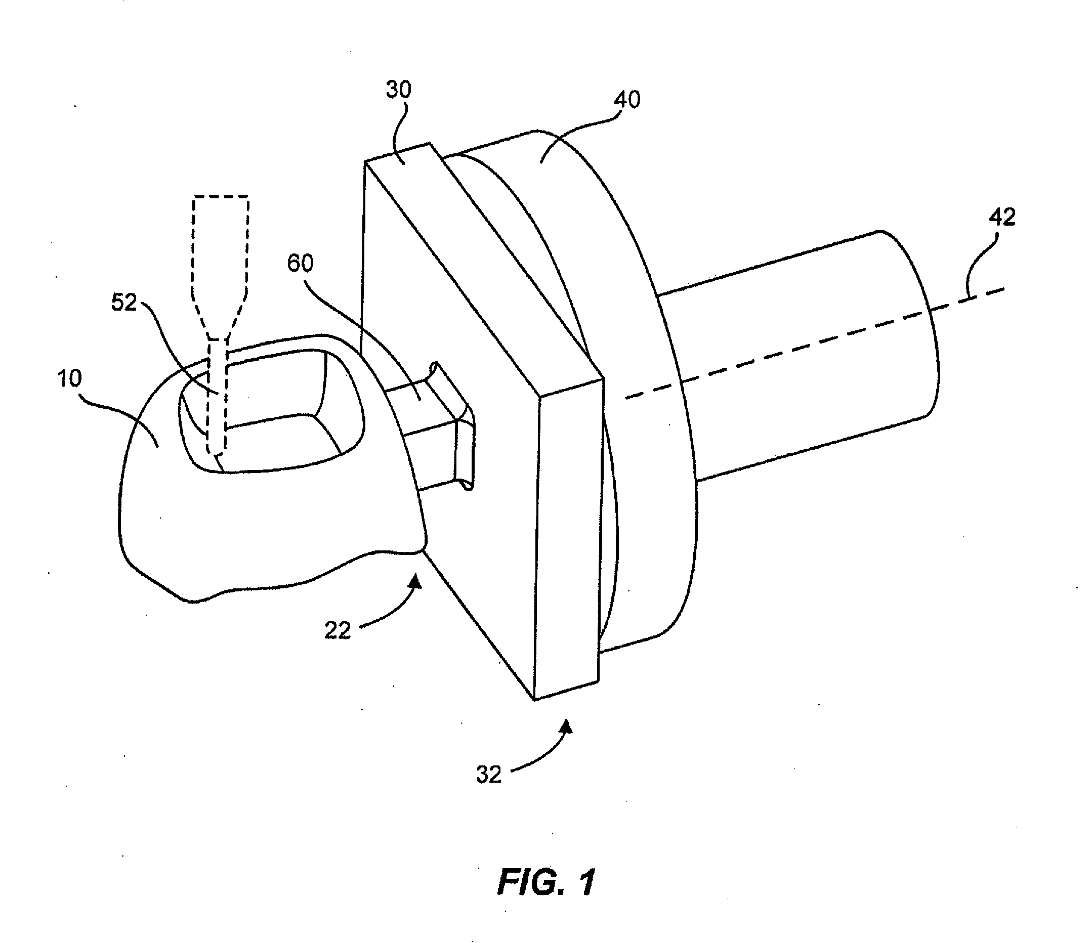 Method for Machining a Dental Prosthesis