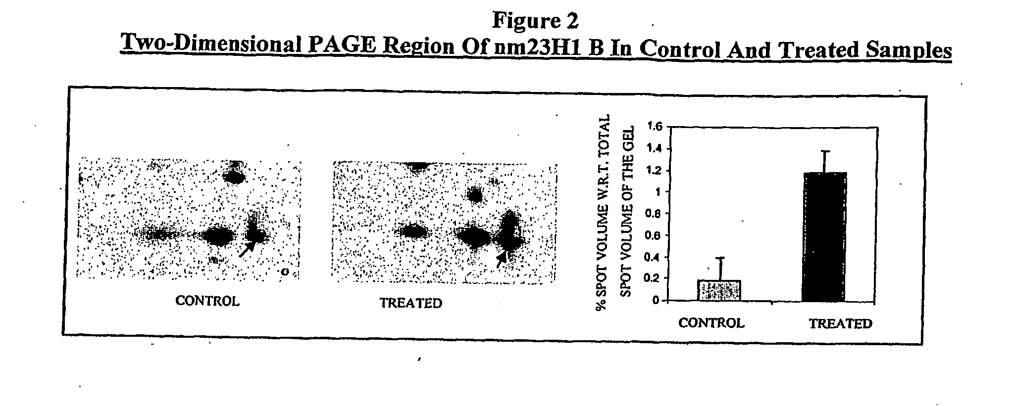 Diagnostic Marker and Therapeutic Target for Cancer