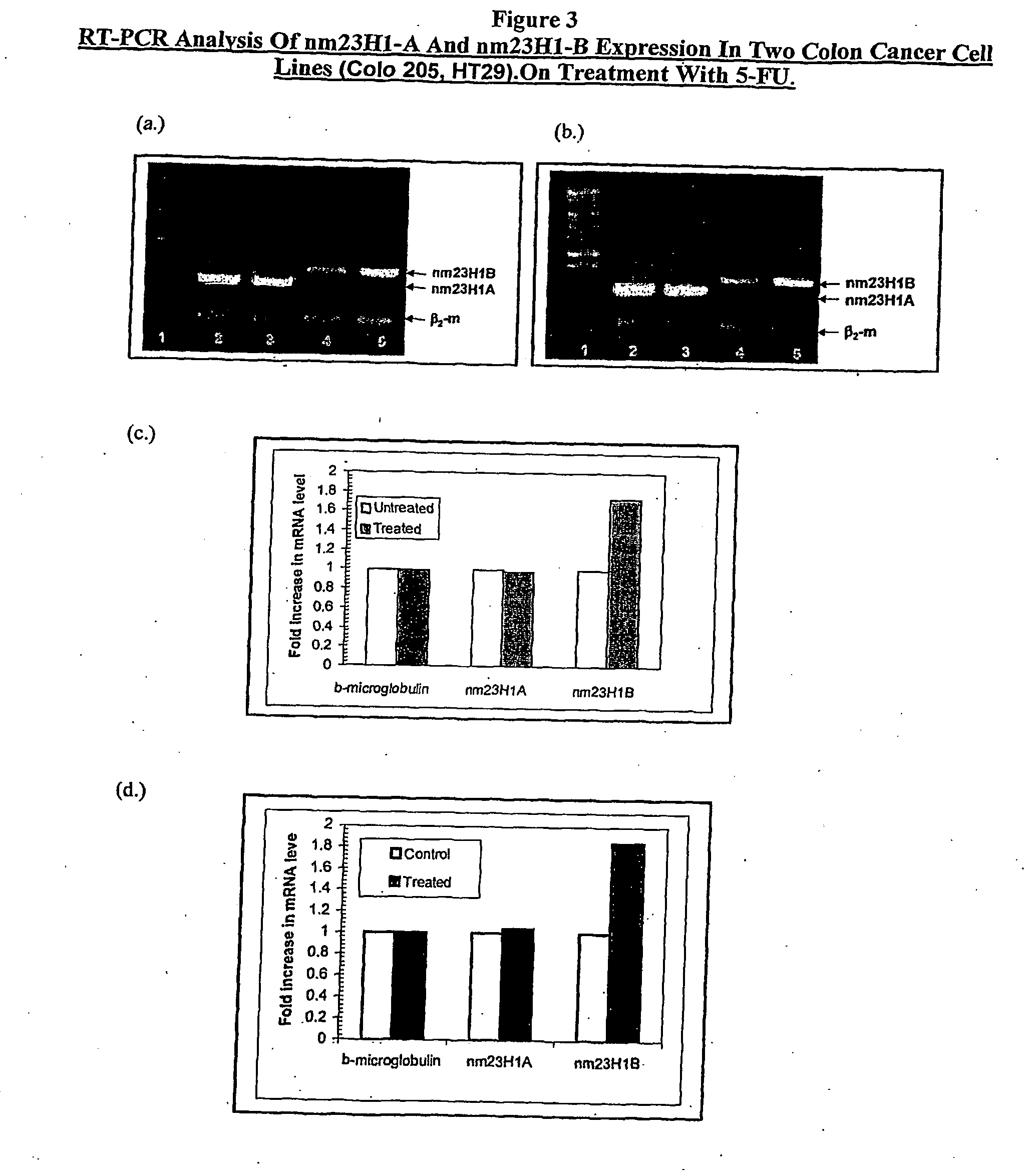 Diagnostic Marker and Therapeutic Target for Cancer