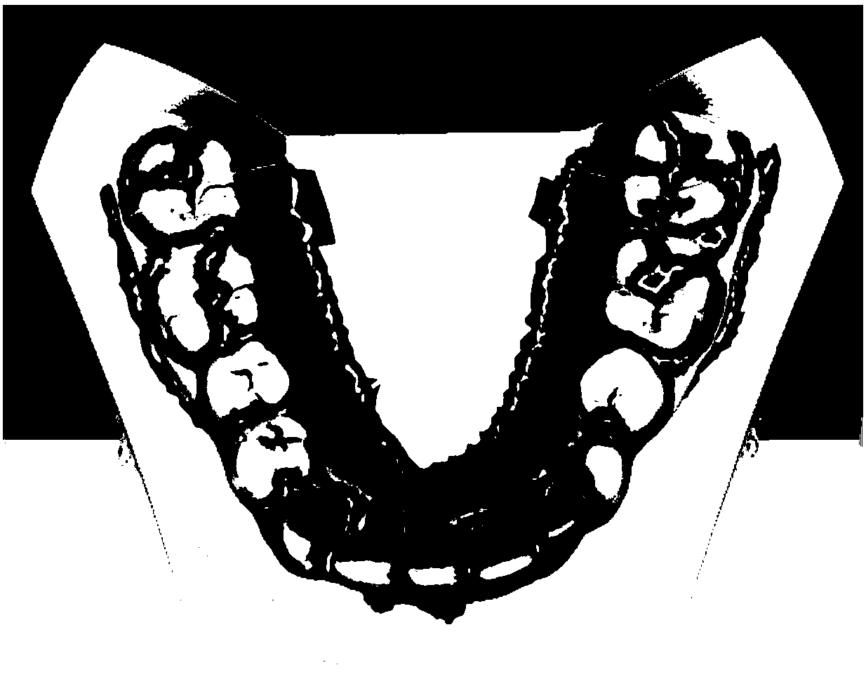 Automatic segmentation method of tooth three-dimensional network model