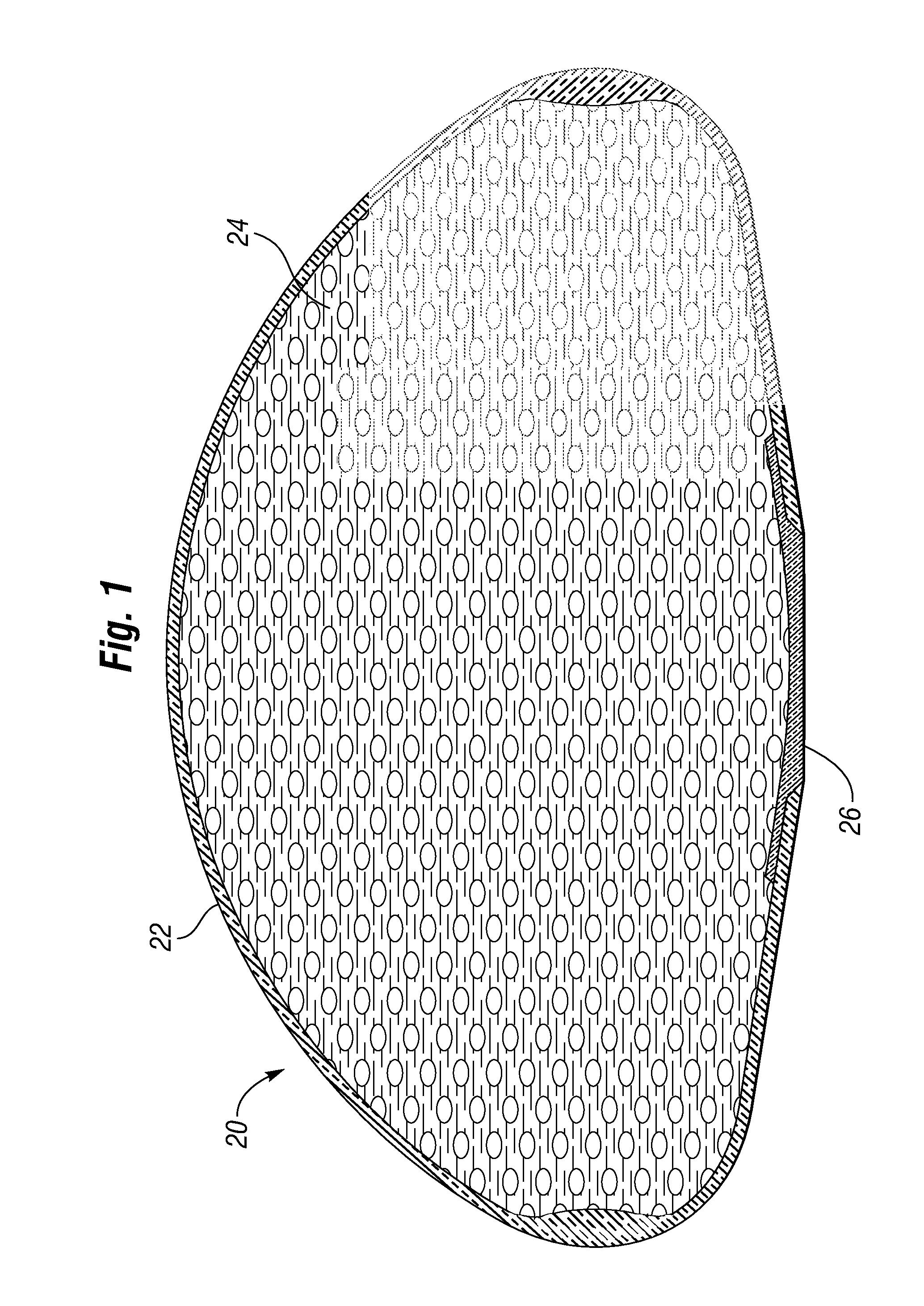 Reinforced prosthetic implant with flexible shell