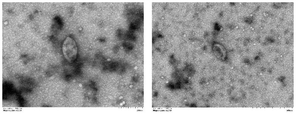 Method for increasing content of exosomes released by cells