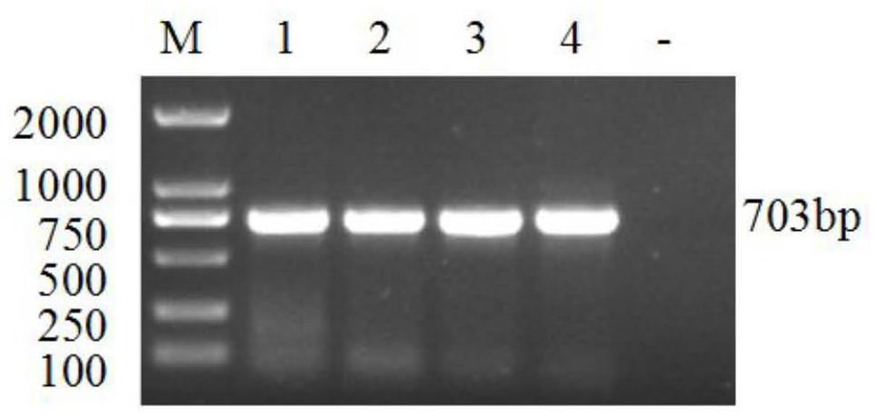 Quadruple RT-PCR detection primers and kits for four porcine diarrhea viruses