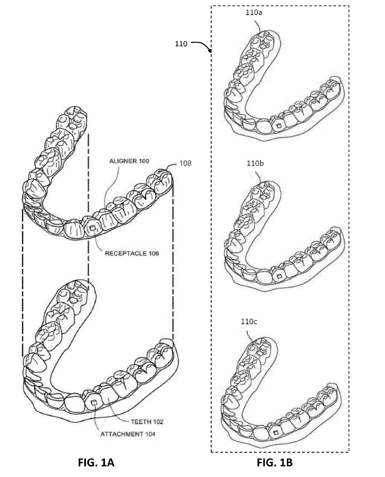 Dental appliance having selective occlusal loading and controlled intercuspation