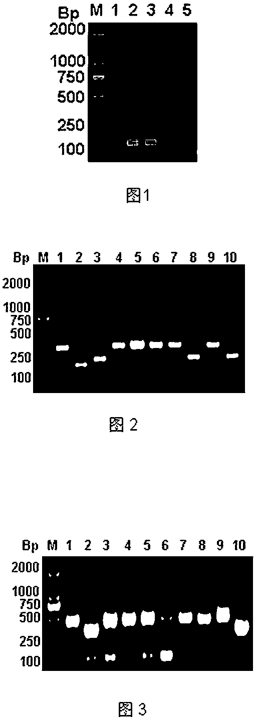 Interest protein preparation method and purpose thereof