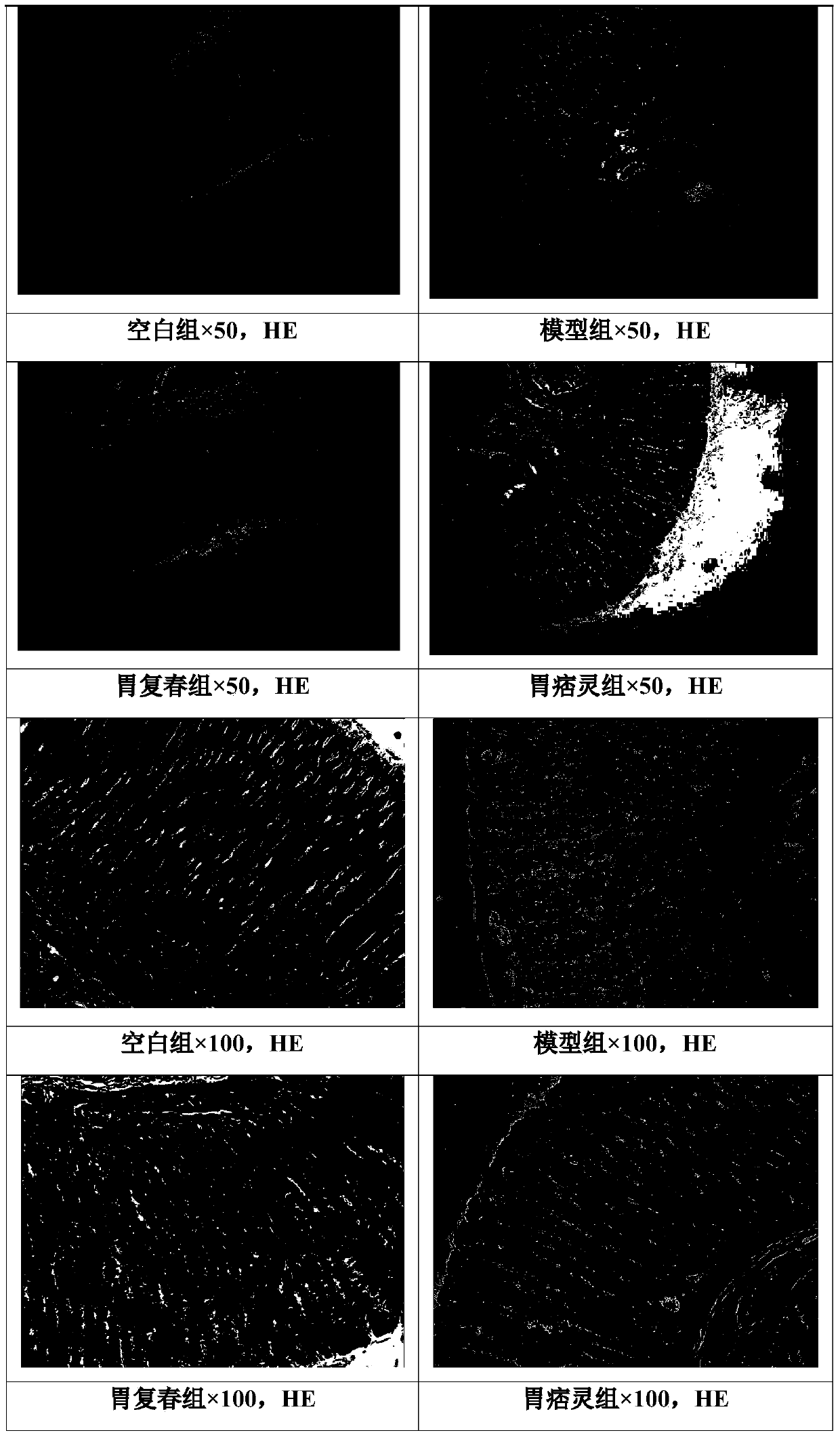 Traditional Chinese medicine composition for treating chronic atrophic gastritis, preparation method and application thereof