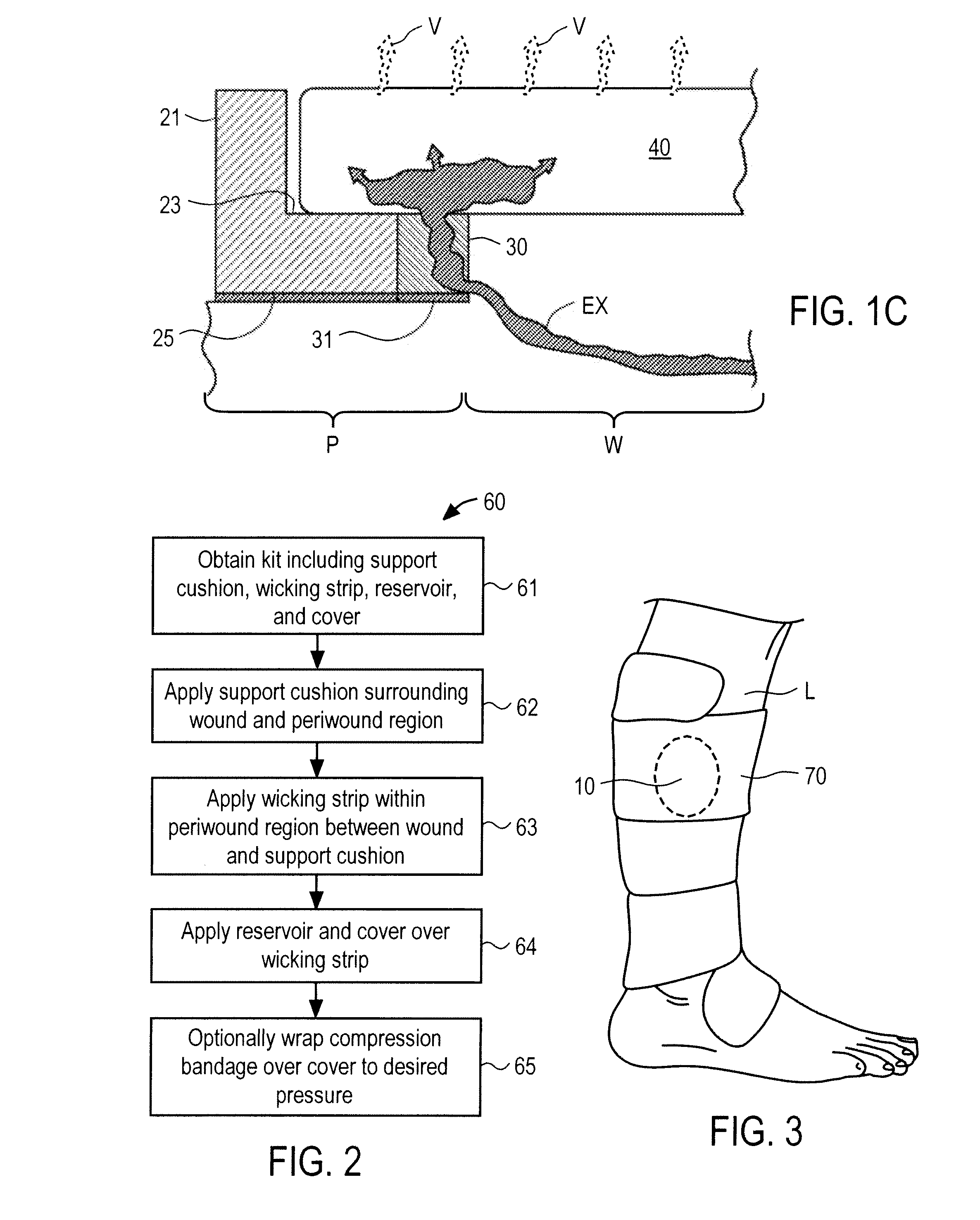 Secondary Wound Dressings for Securing Primary Dressings and Managing Fluid from Wounds, and Methods of Using Same