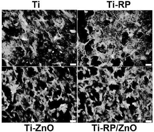 Preparation method of red phosphorus-zinc oxide heterojunction film for rapid photocatalytic sterilization