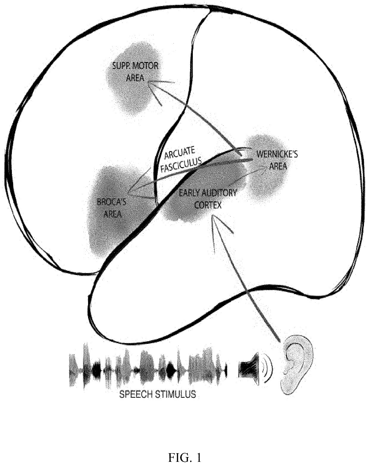 Rapid mapping of language function and motor function without subject participation