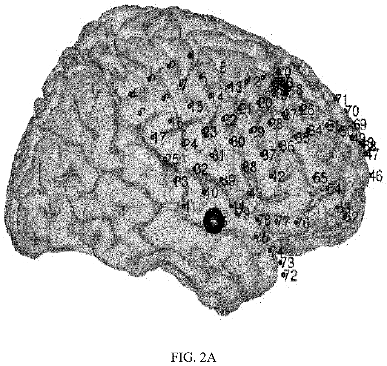 Rapid mapping of language function and motor function without subject participation