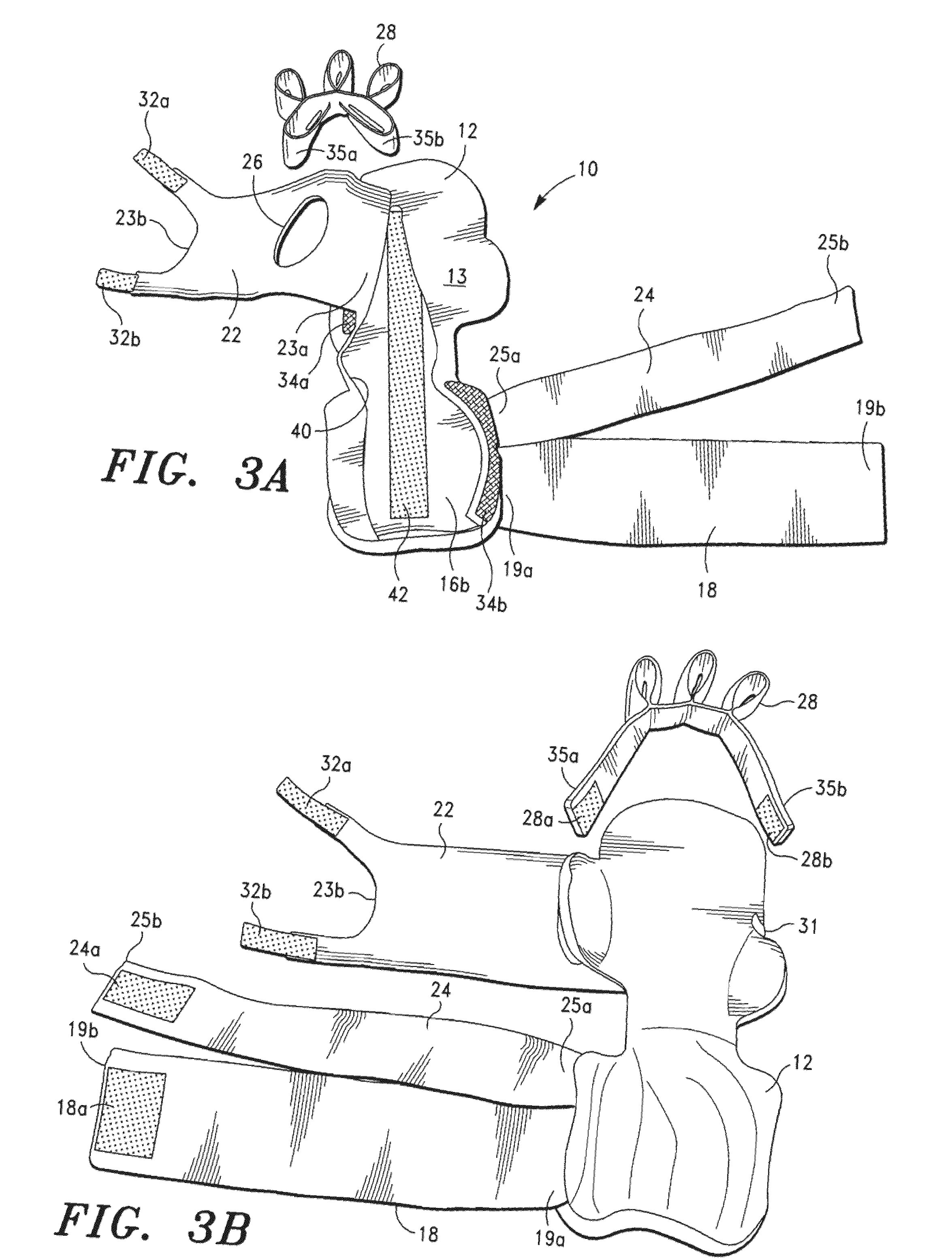 Orthosis