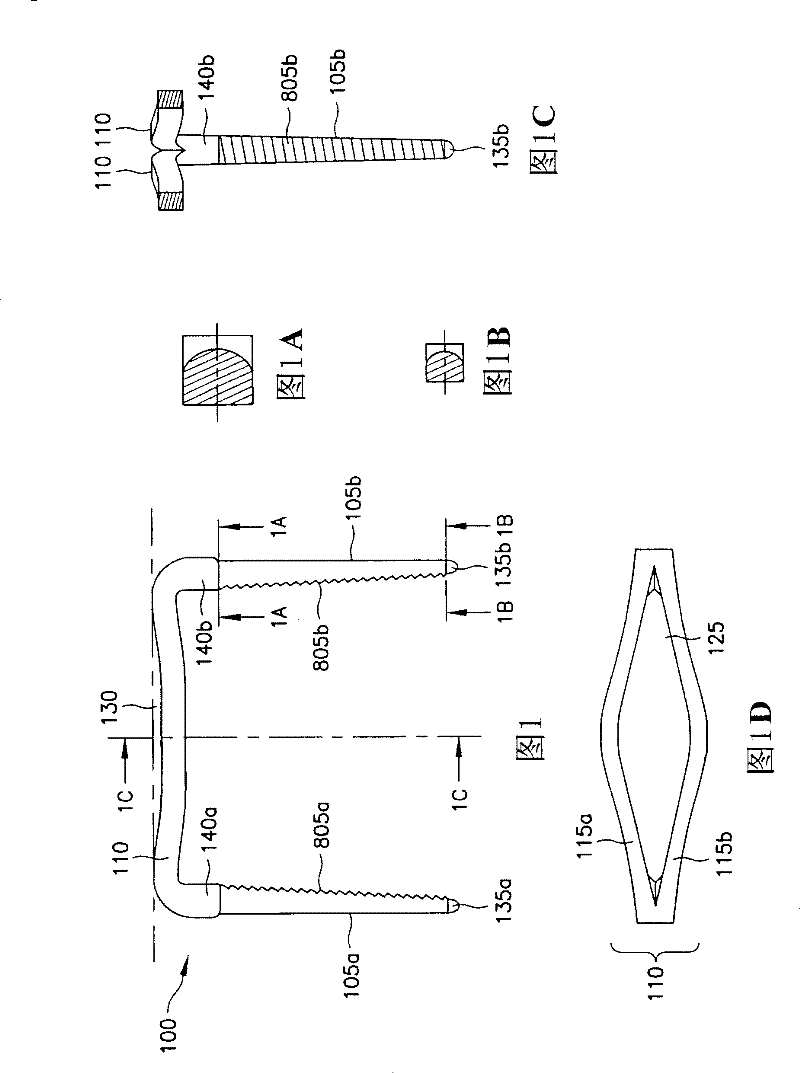 Bone synthesis clip and surgical operation system including bone synthesis clip