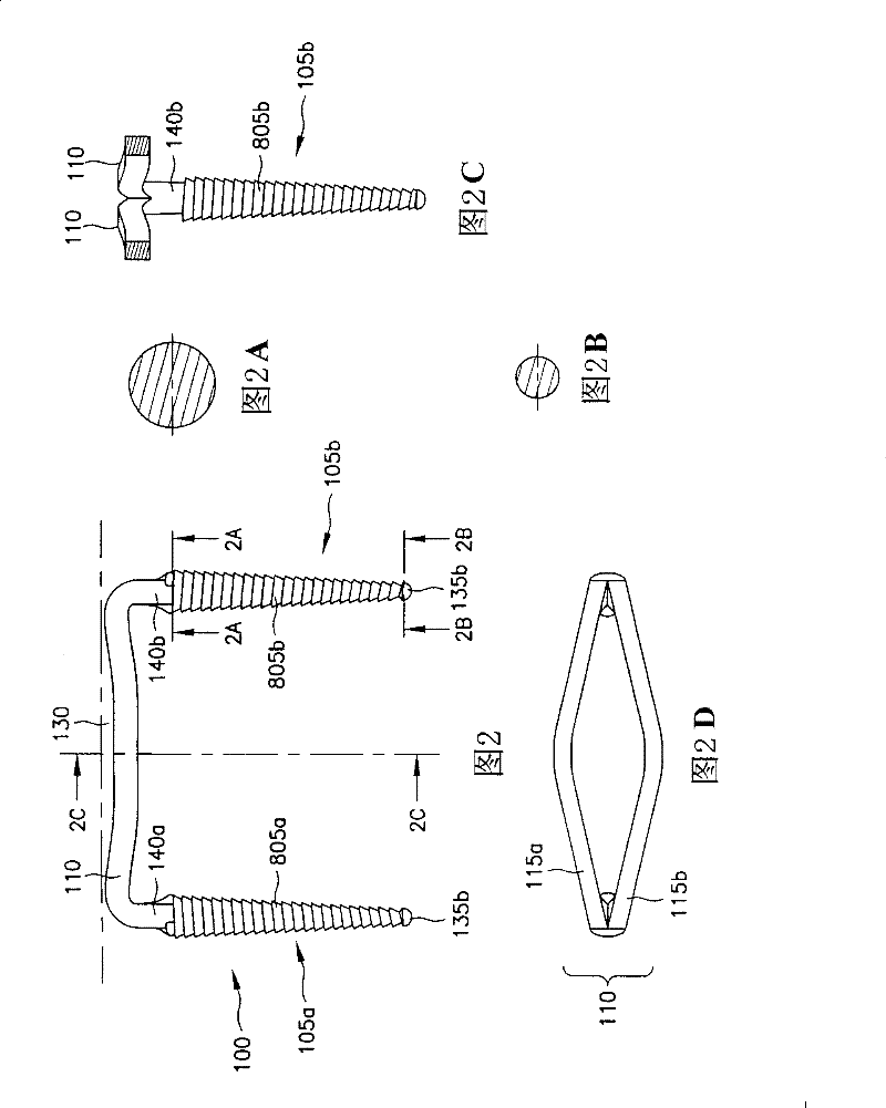 Bone synthesis clip and surgical operation system including bone synthesis clip