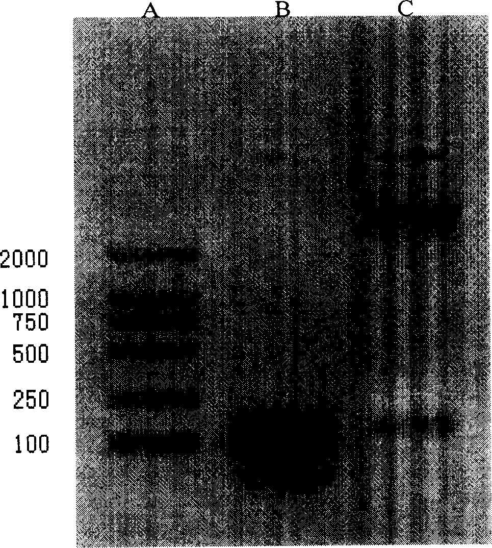 Gene of coding recombination buman natriurea and method of producing recombination human natriurea using said gene