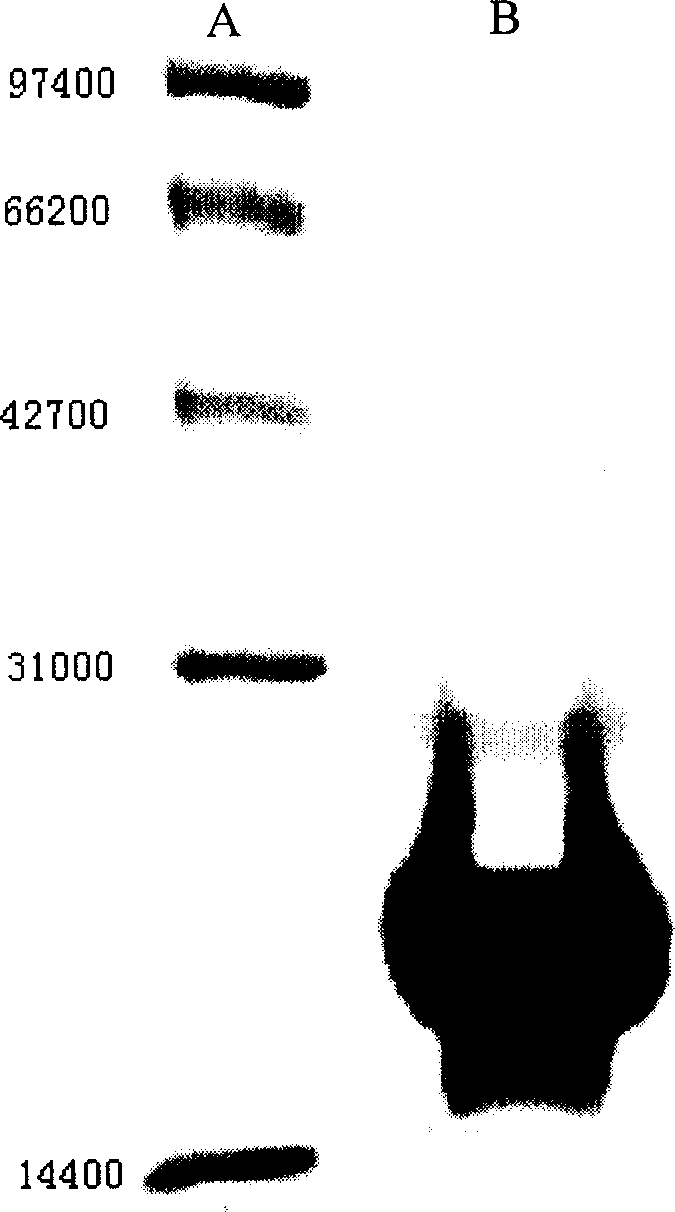 Gene of coding recombination buman natriurea and method of producing recombination human natriurea using said gene