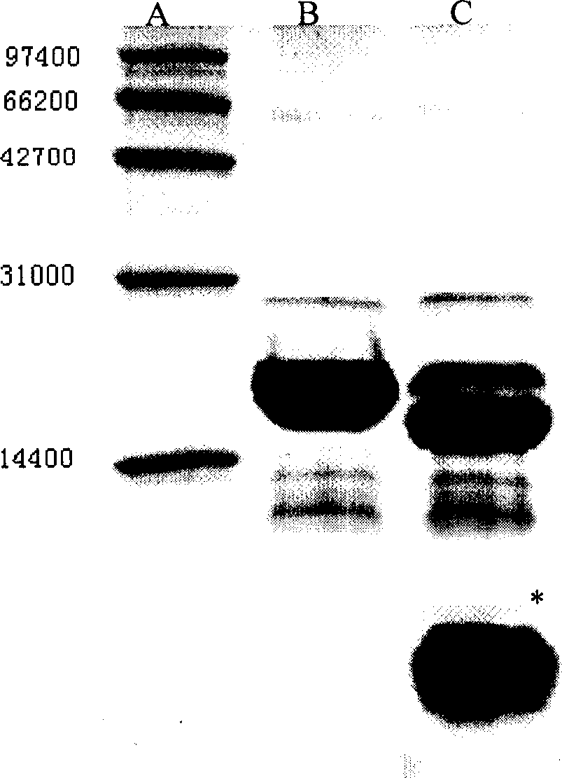 Gene of coding recombination buman natriurea and method of producing recombination human natriurea using said gene