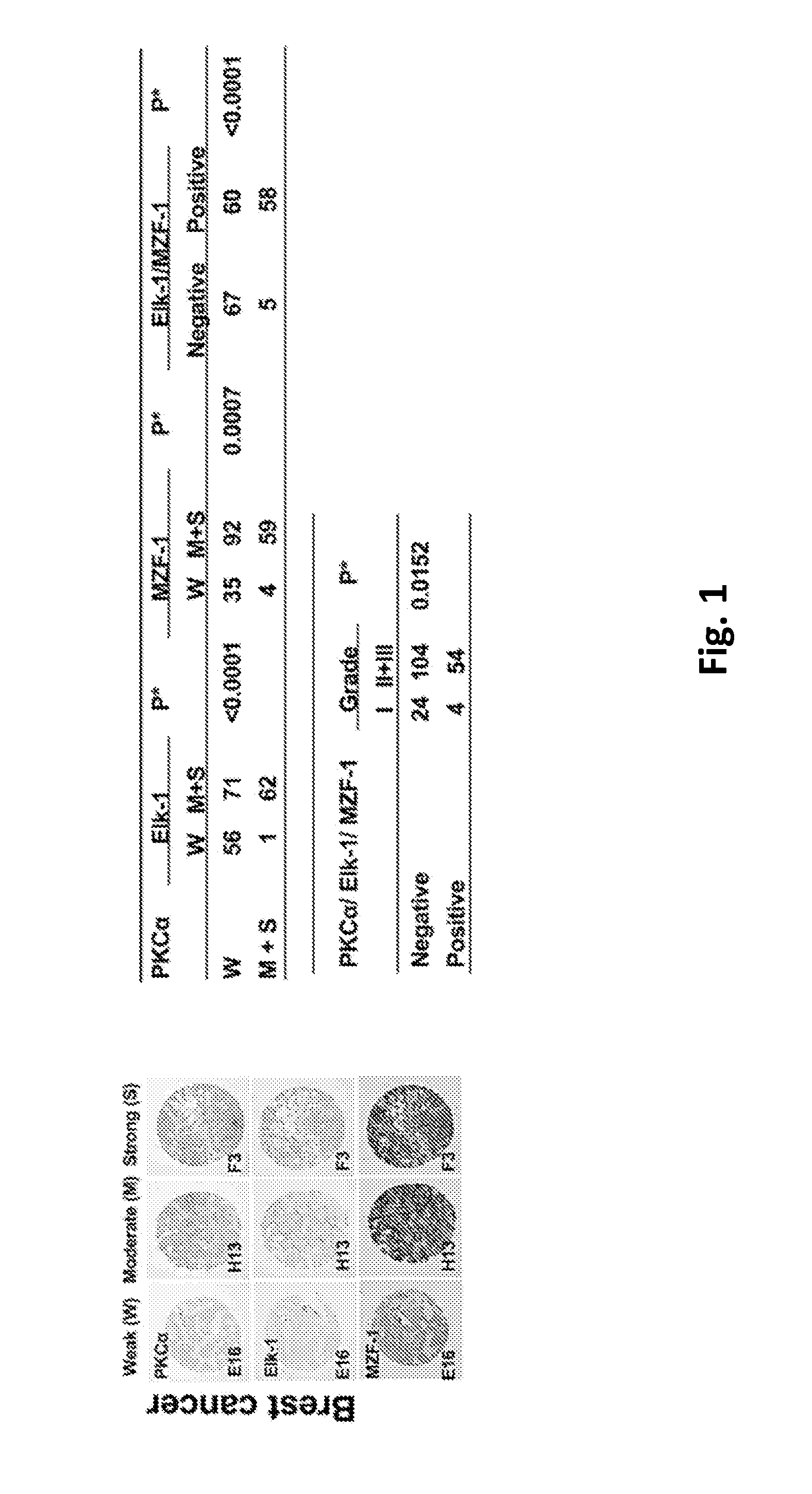 Pharmaceutical composition inhibiting interaction between MZF-1 and Elk-1