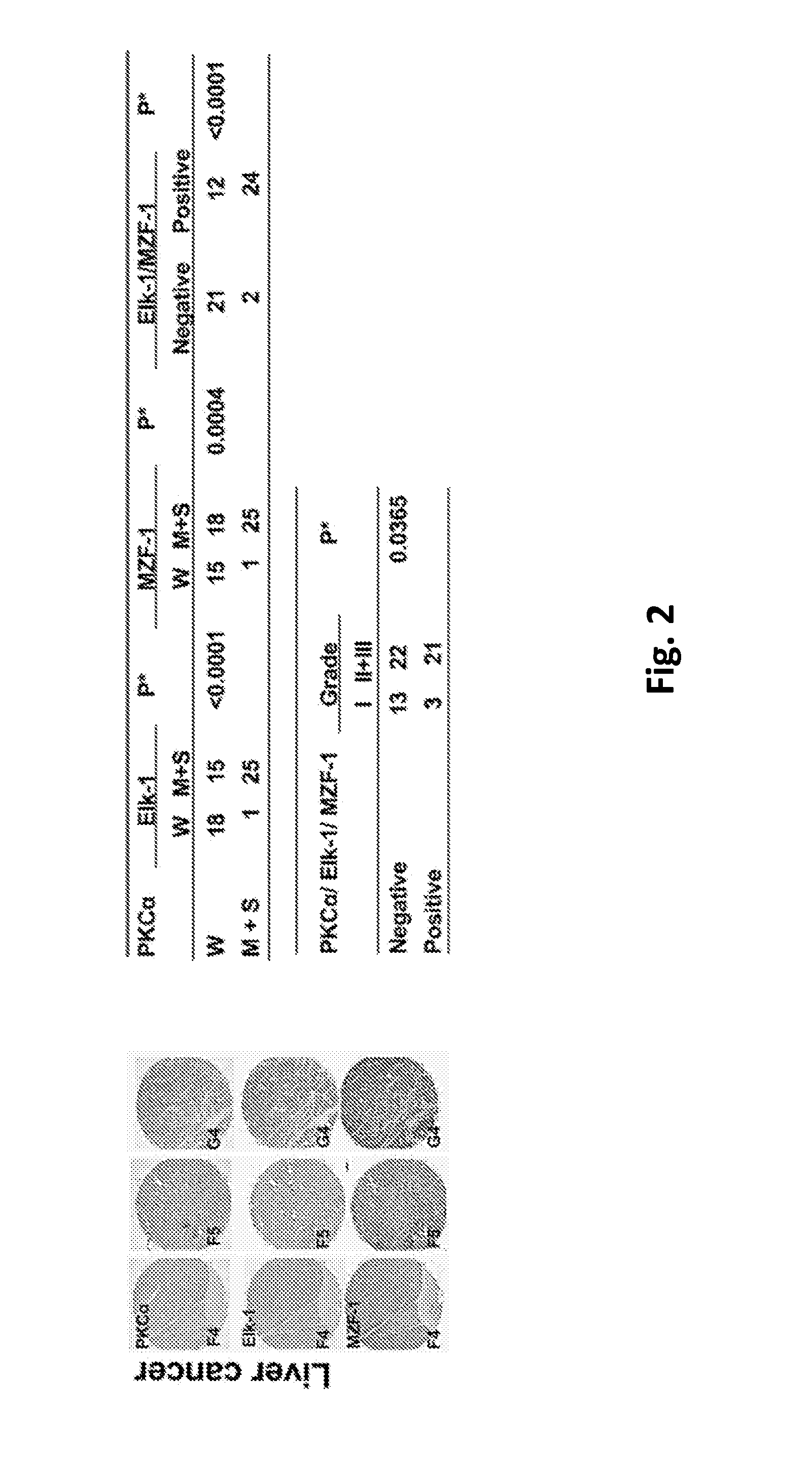 Pharmaceutical composition inhibiting interaction between MZF-1 and Elk-1