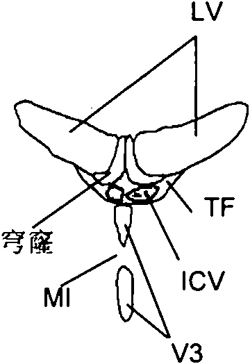 A method and system for anatomy structure segmentation and modeling in an image