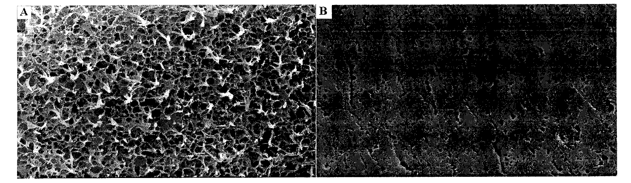 Polyester flat microporous membrane and preparation method thereof