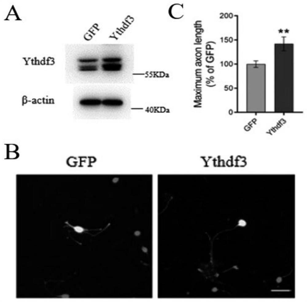 Application of RNA binding protein Ythdf3, target spot for treating nerve axon injury and medicine