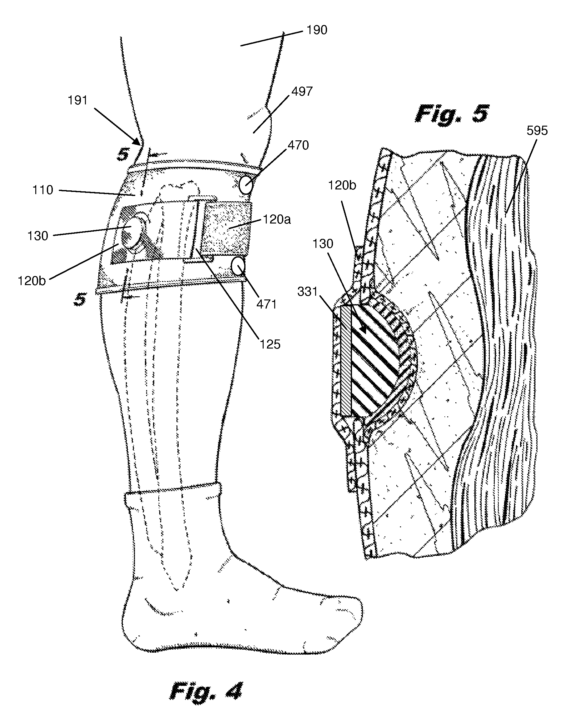 Pain-alleviating orthopaedic appliance