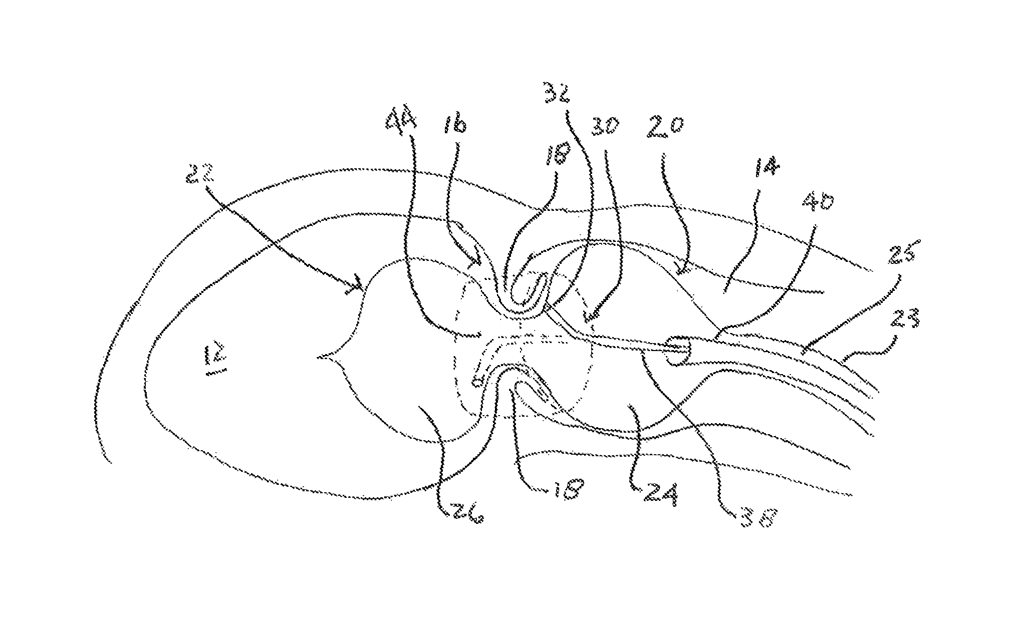 Shock wave valvuloplasty device with moveable shock wave generator
