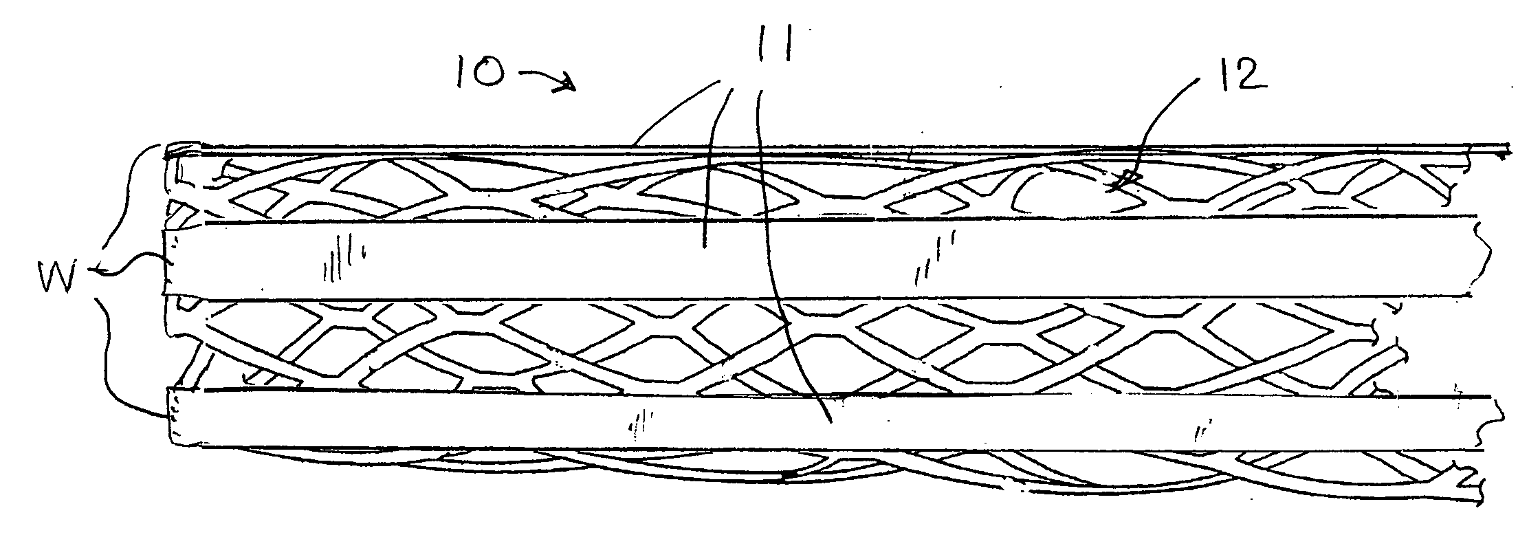Stent with auxiliary treatment structure