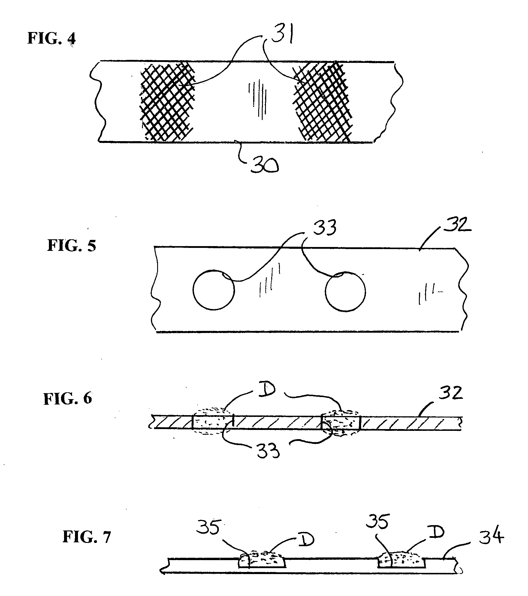Stent with auxiliary treatment structure