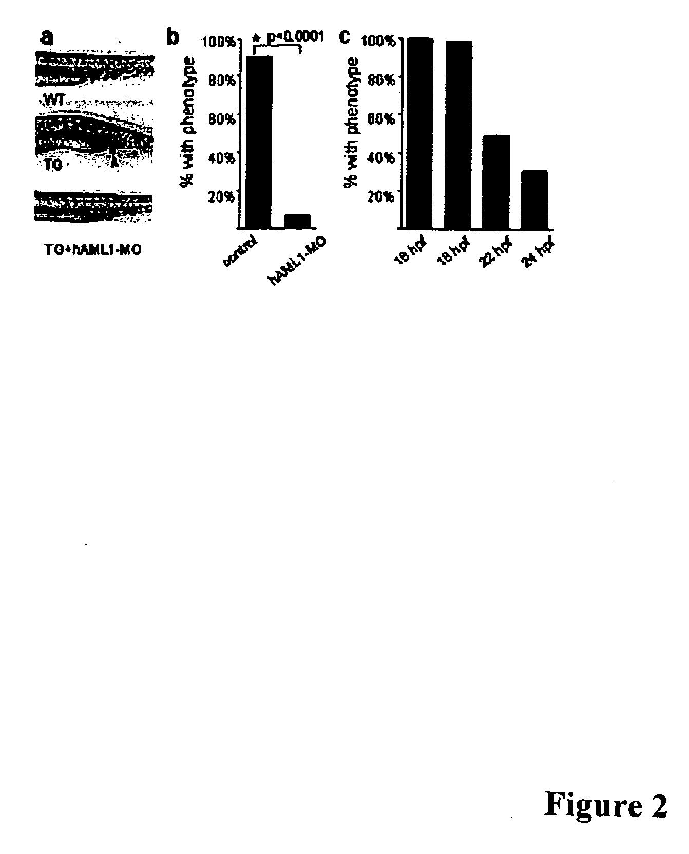 Zebrafish models of acute myelogenous leukemia