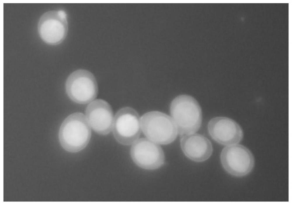 A kind of staining method of Eimeria tenella protoplasts