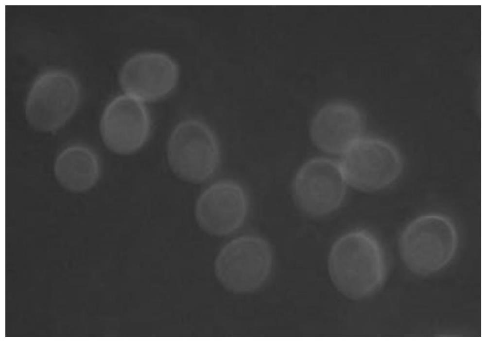A kind of staining method of Eimeria tenella protoplasts
