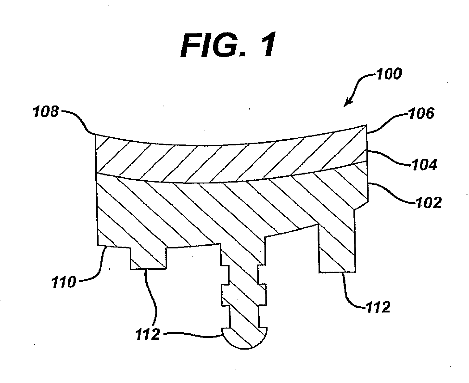 Glenoid augment and associated method