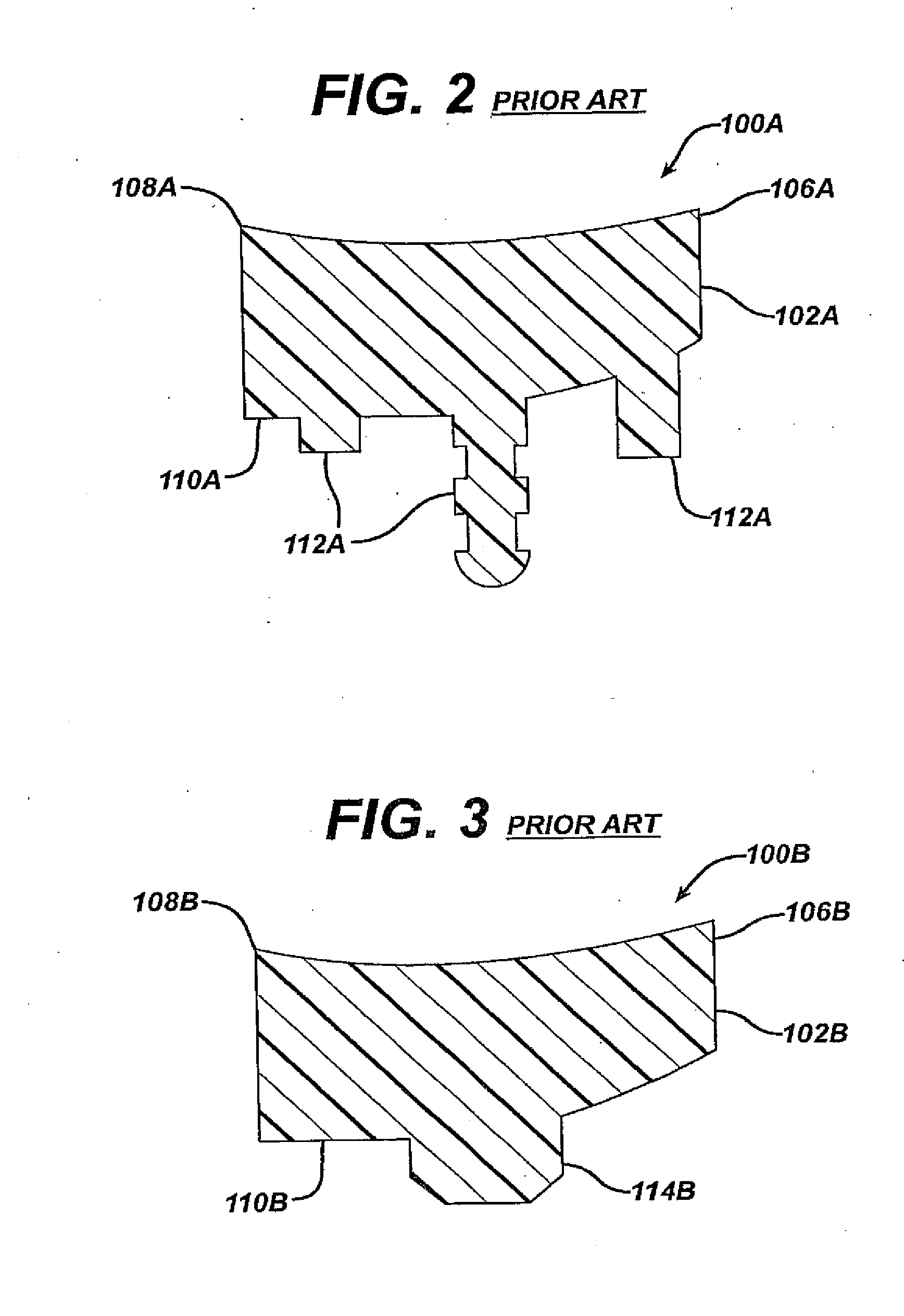 Glenoid augment and associated method