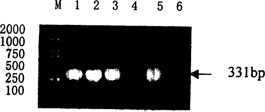 Detection type gene chip for detecting various infectious desease and use thereof