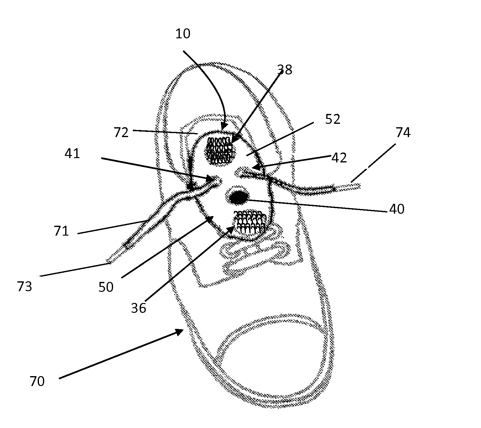 Device to secure shoelace knot