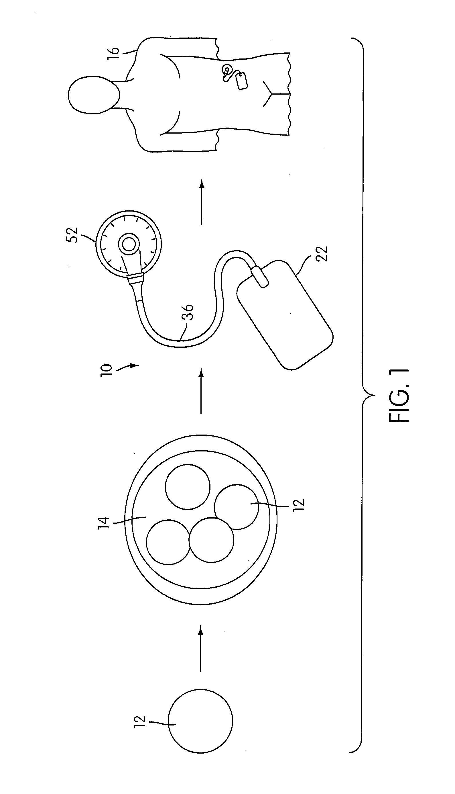 Angiogenesis Mechanism and Method, and Implantable Device