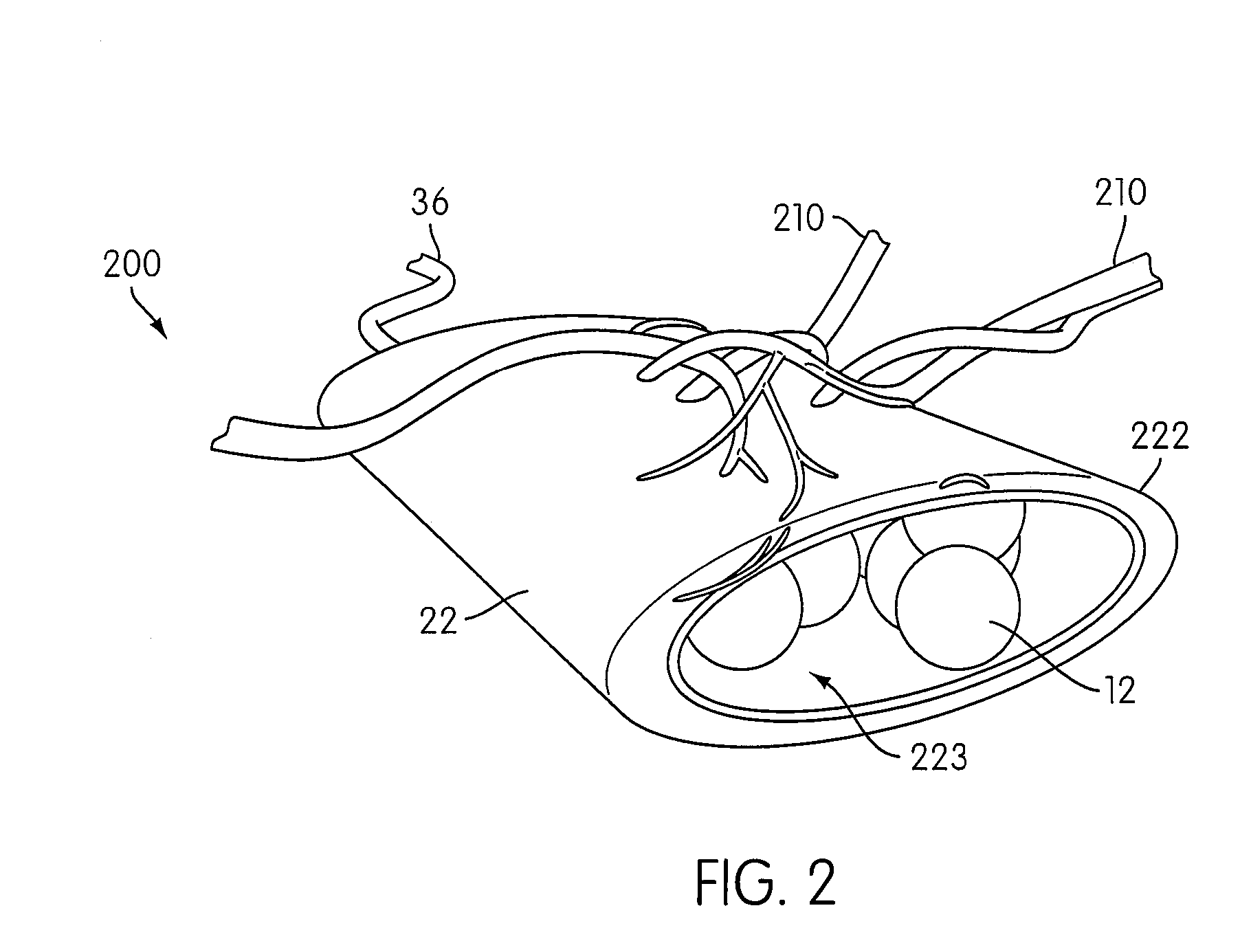 Angiogenesis Mechanism and Method, and Implantable Device