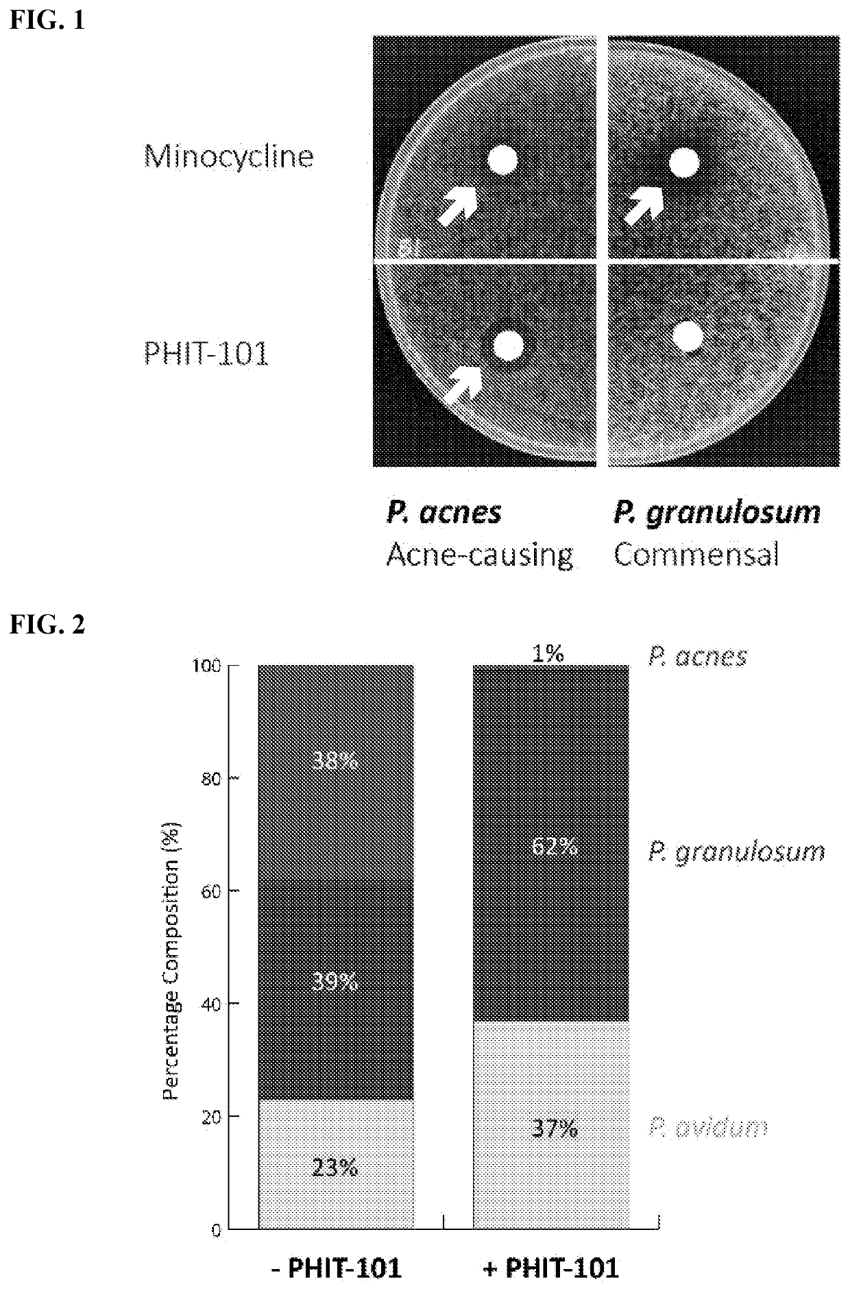 Compositions comprising propionibacterium acnes bacteriophages for treating acne