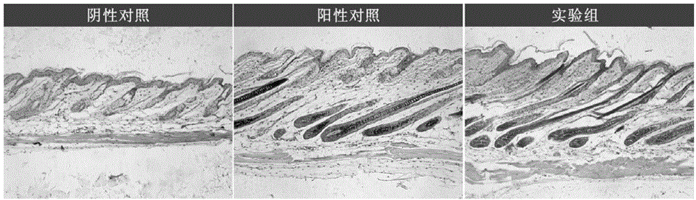 Application of N-(4-chloro-2,5-dimethoxyphenyl)-5-isopropyl-2-methoxybenzenesulfonamide in promotion of hair growth