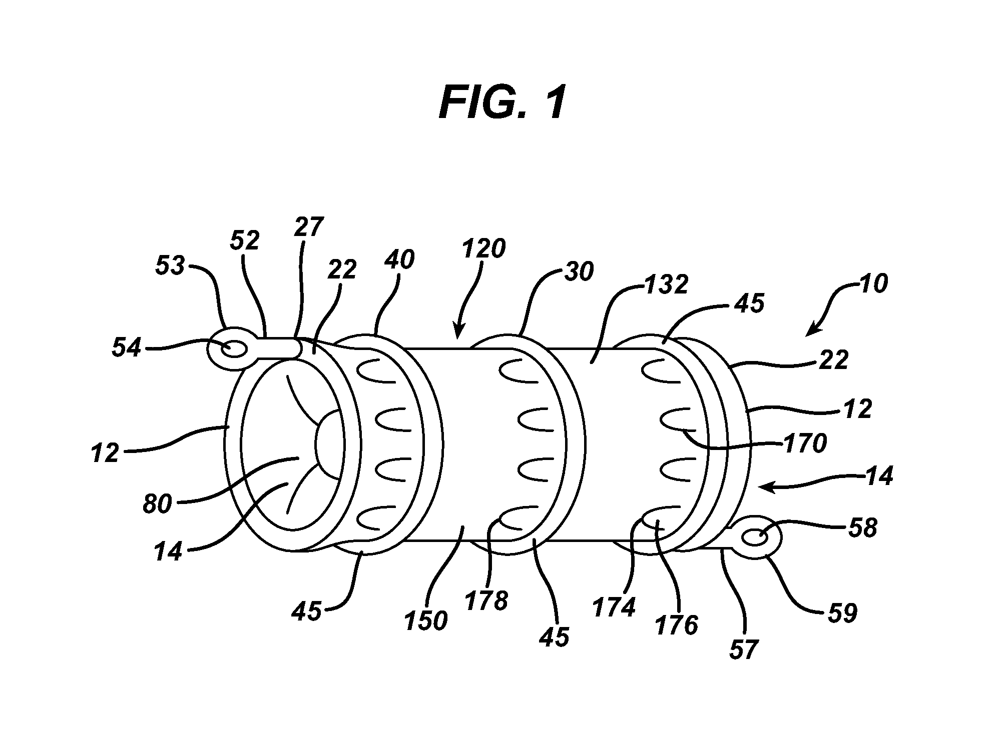 Negative pressure intestinal anastomosis protection devices