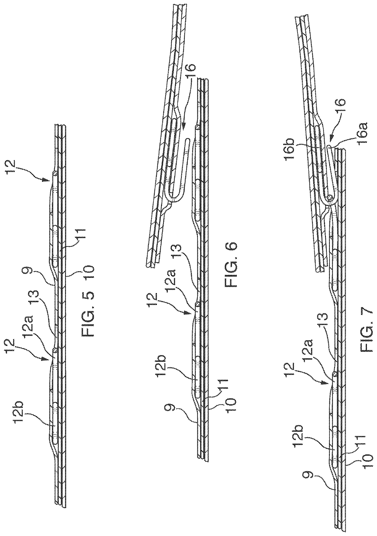 Fastening system and method of manufacturing thereof