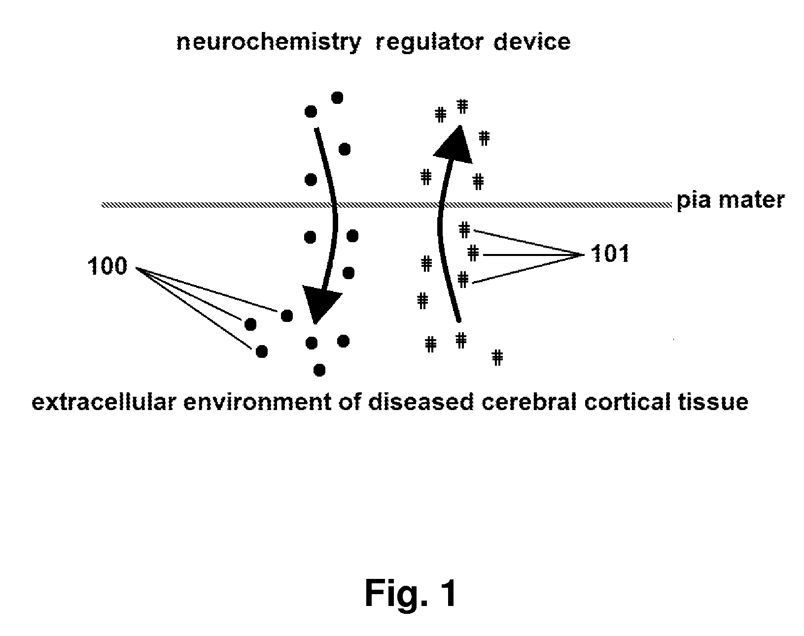 Apparatus and use of a neurochemisrty regulator device insertable in the cranium for the
treatment of cerebral cortical disorders